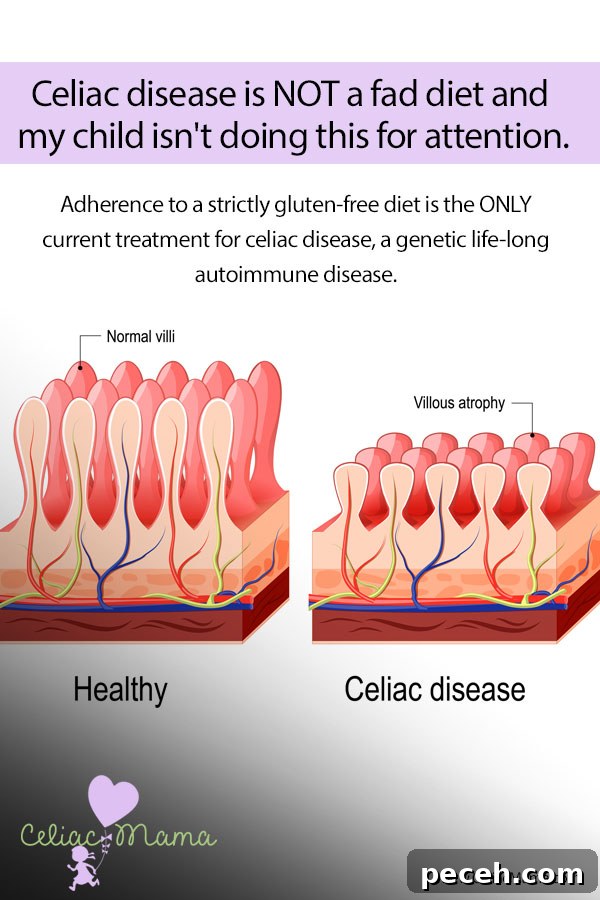 Celiac-Disease Awareness-Not-a-Fad-Diet